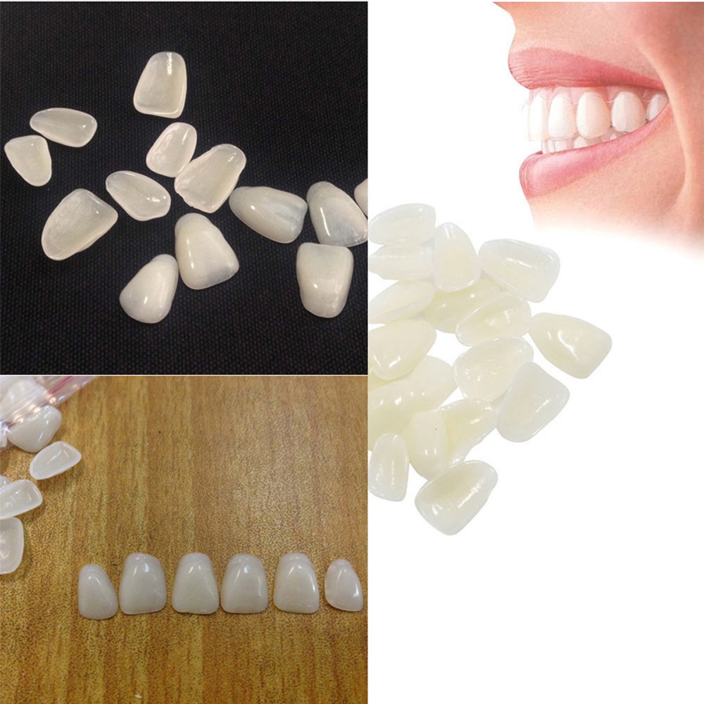 Teeth Whitening Veneers - 70PCS/Package Dental Ultra-Thin Whitening Veneers Resin