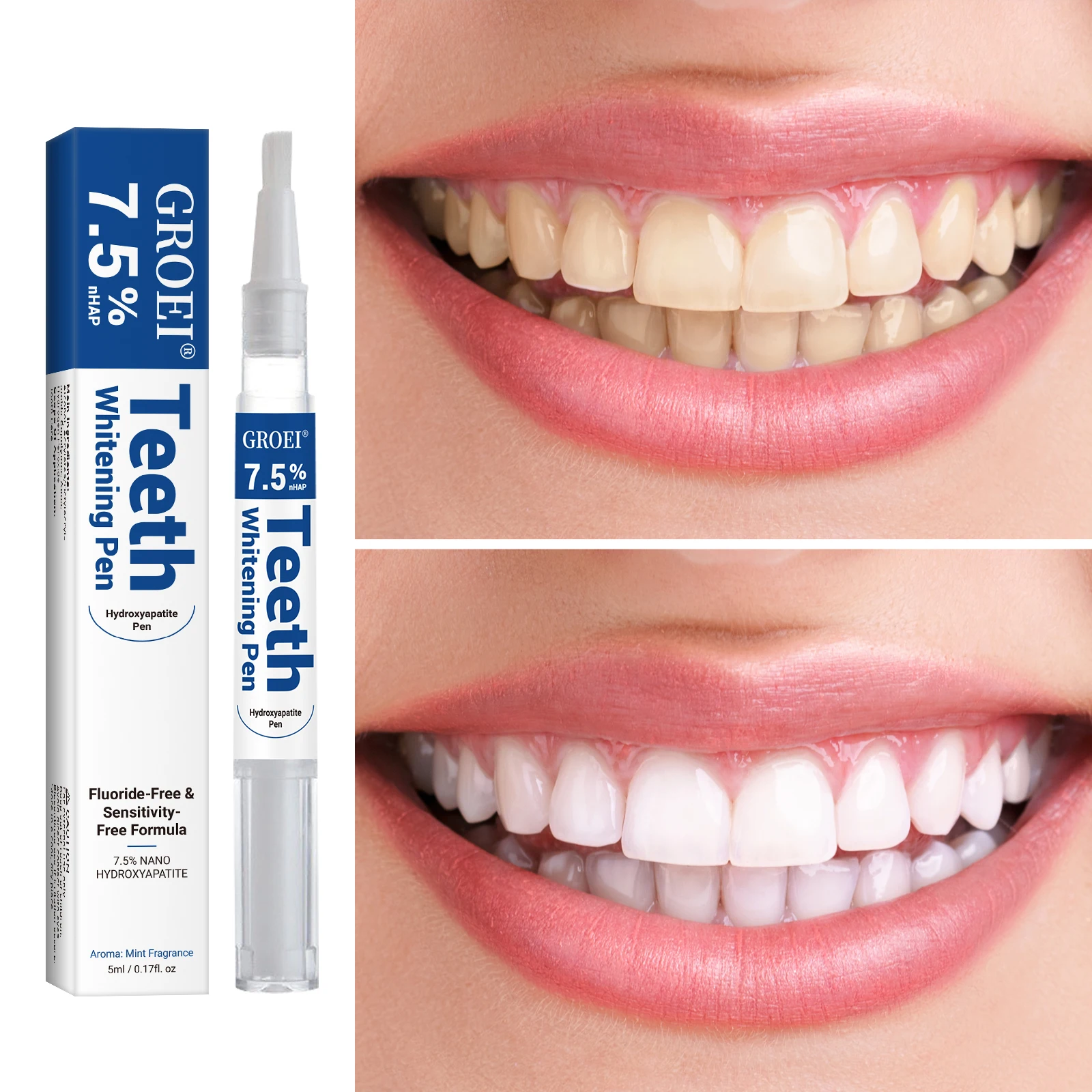 Hydroxyapatite Tooth Whitening - огляд і ціна Teeth Whitening Near Me