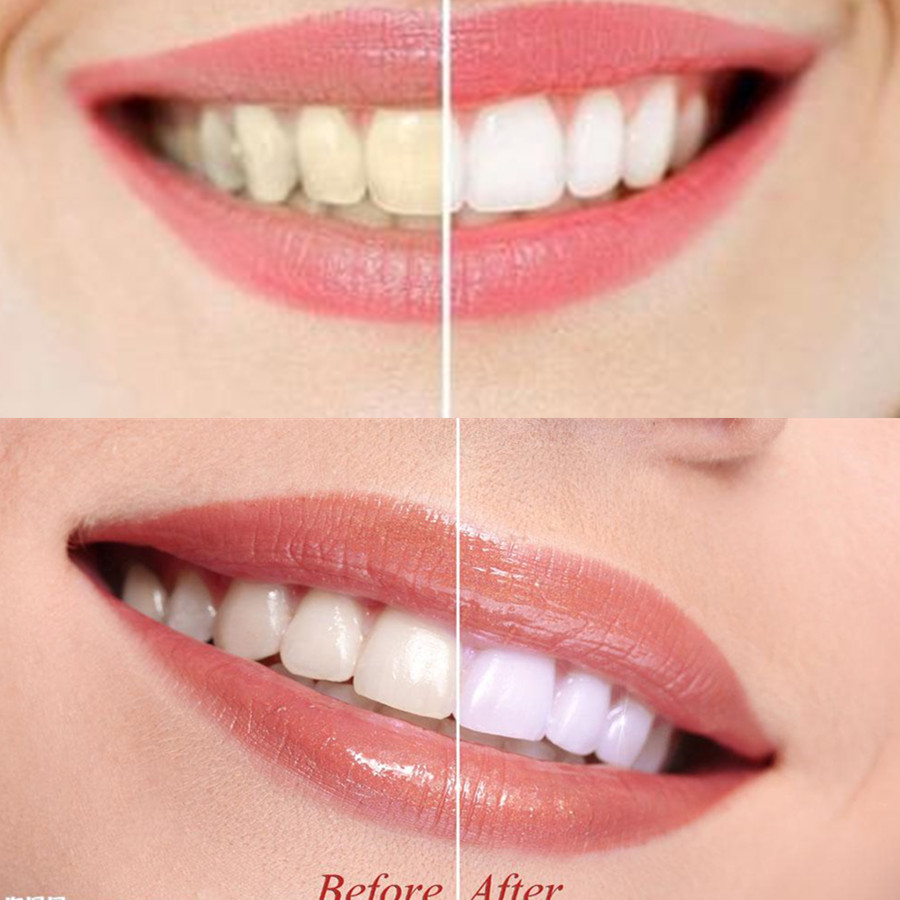 Bamboo Charcoal Teeth Tooth De - огляд і ціна Teeth Whitening Yellow Teeth