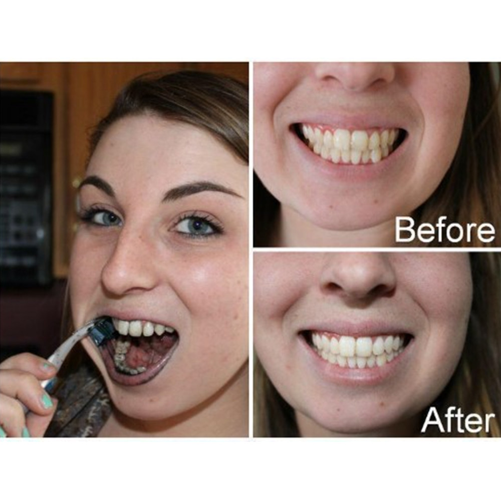 Bamboo Charcoal Teeth Tooth De - огляд і ціна Teeth Whitening Yellow Teeth