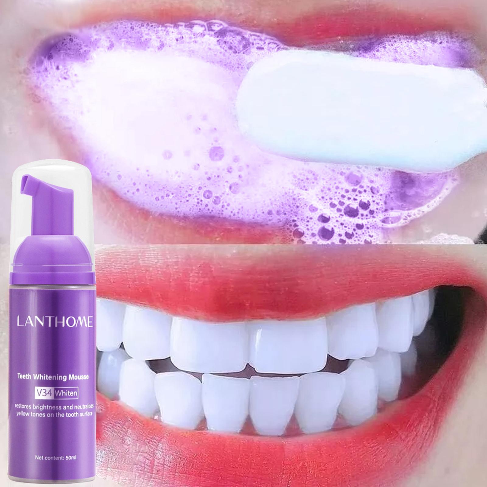 V34 Mousse Teeth Cleaning Toot - огляд і ціна Teeth Whitening Yellow Teeth
