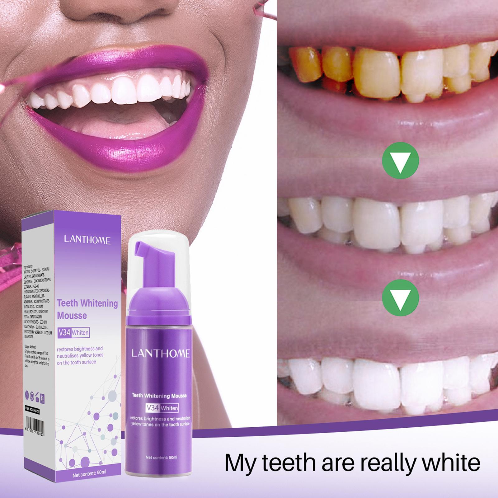 V34 Mousse Teeth Cleaning Toot - огляд і ціна Teeth Whitening Yellow Teeth