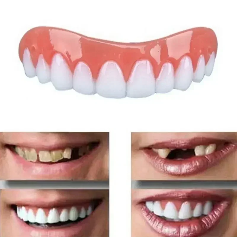 New False Teeth Silicone Upper - огляд і ціна Teeth Whitening Veneers