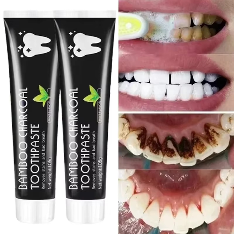 Whitening Toothpaste Bamboo Ch - огляд і ціна Teeth Whitening Yellow Teeth