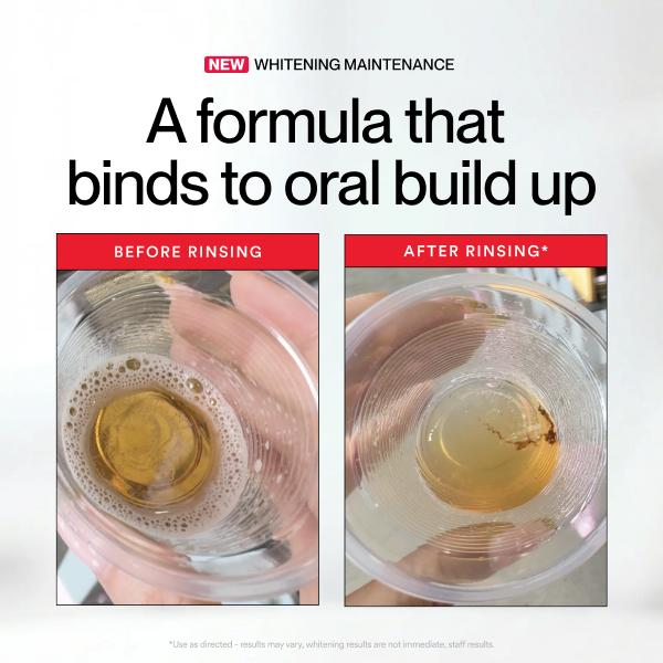 Hismile ID Whitening Stain Mou - огляд і ціна Teeth Whitening With Peroxide