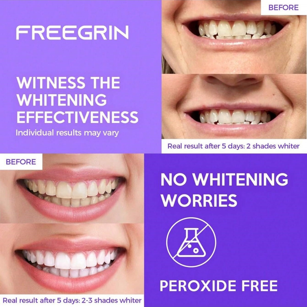 Deluxe Whitening Teeth Sticker - огляд і ціна Teeth Whitening With Peroxide