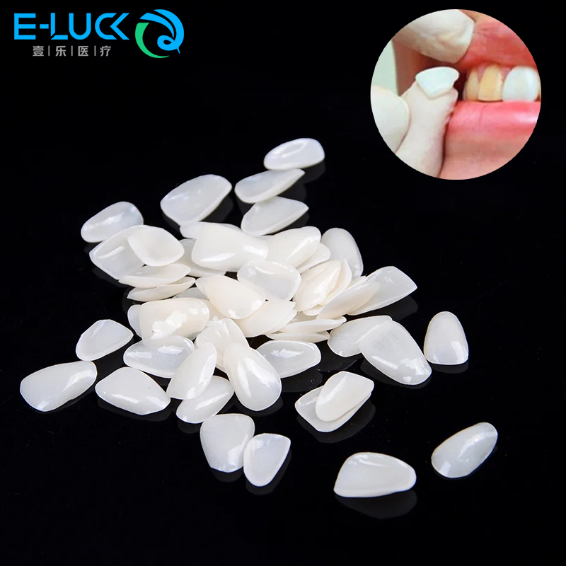 50pcs Dental Teeth Veneers Tem - огляд і ціна Teeth Whitening Veneers