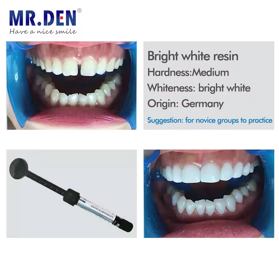 Nano Enamel Veneer Material Te - огляд і ціна Teeth Whitening Veneers