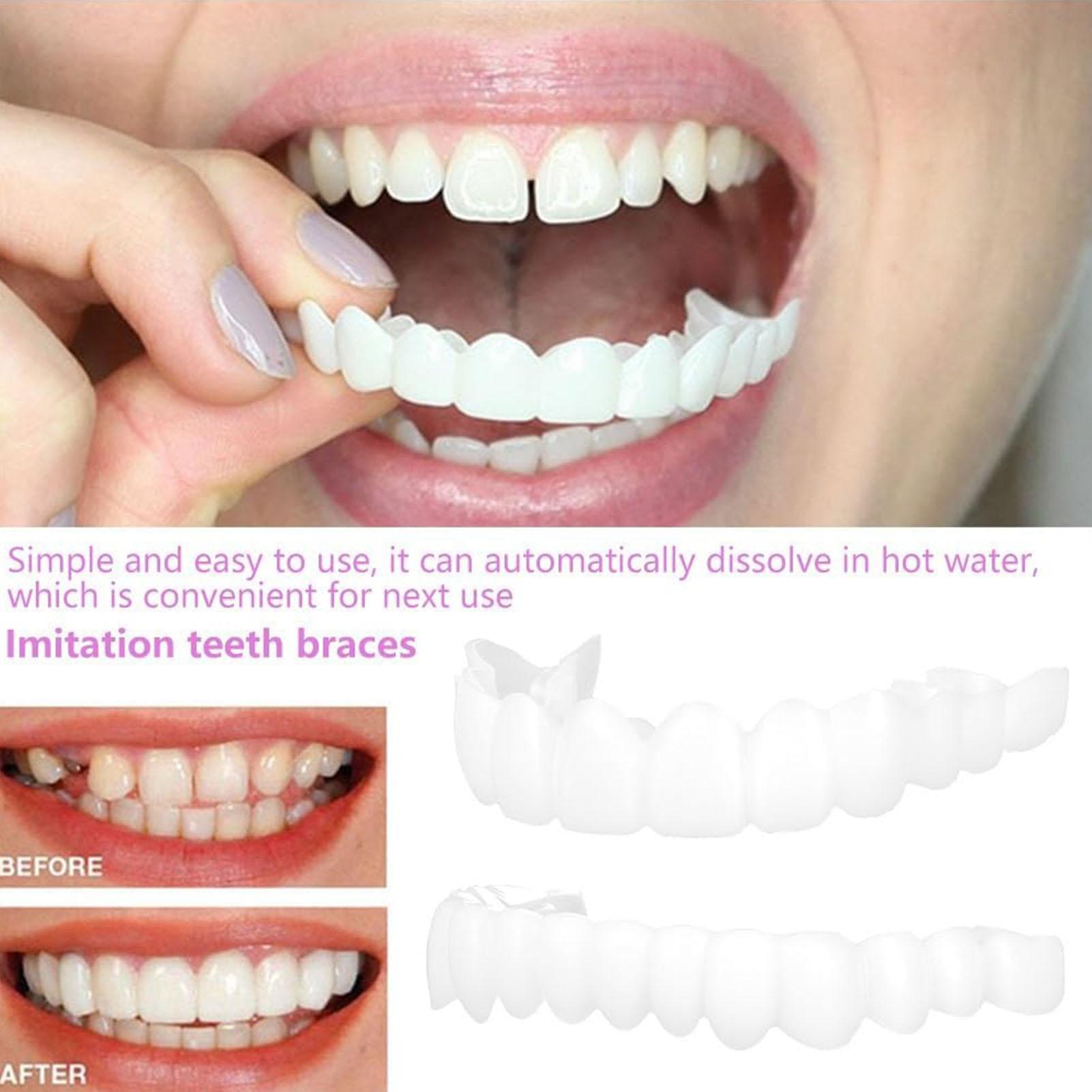 2pcs Men Women Temporary Teeth - огляд і ціна Teeth Whitening Veneers